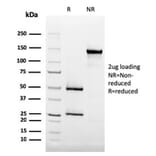 SDS-PAGE - Anti-CD35 Antibody [SPM554] (A248258) - Antibodies.com
