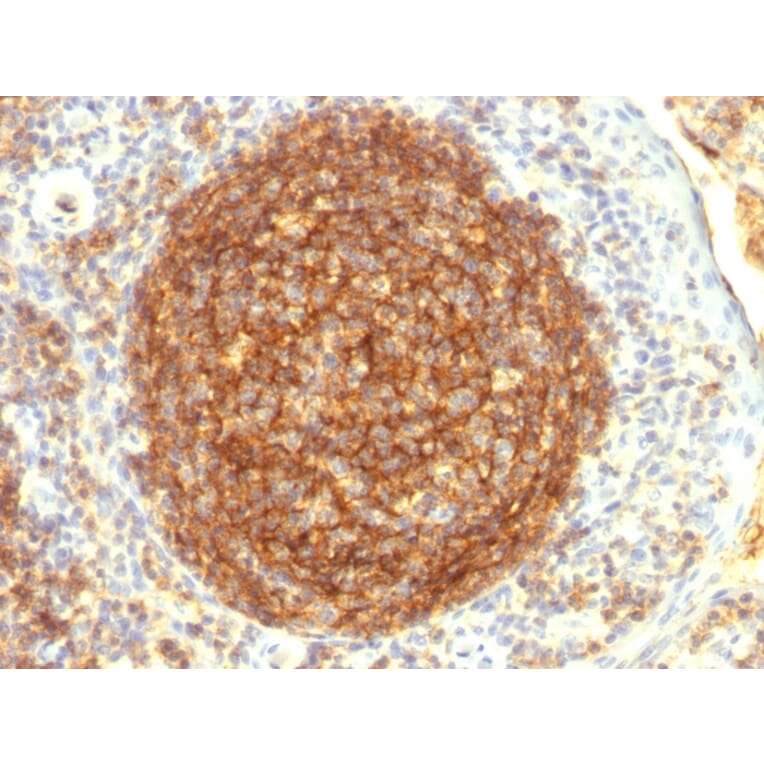 Immunohistochemistry - Anti-CD35 Antibody [CR1/802] (A248258) - Antibodies.com