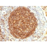 Immunohistochemistry - Anti-CD35 Antibody [CR1/802] (A248258) - Antibodies.com