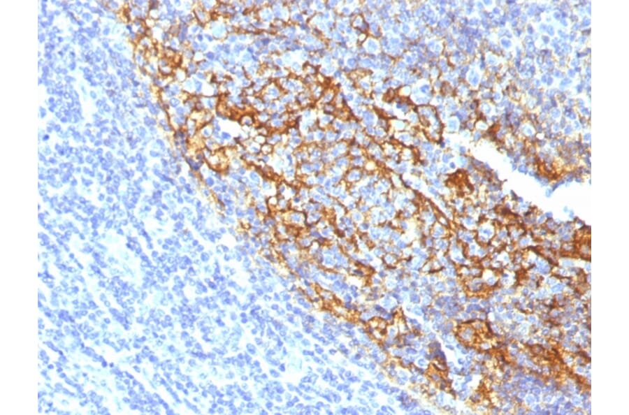 Immunohistochemistry - Anti-CD35 Antibody [To5] (A248259) - Antibodies.com