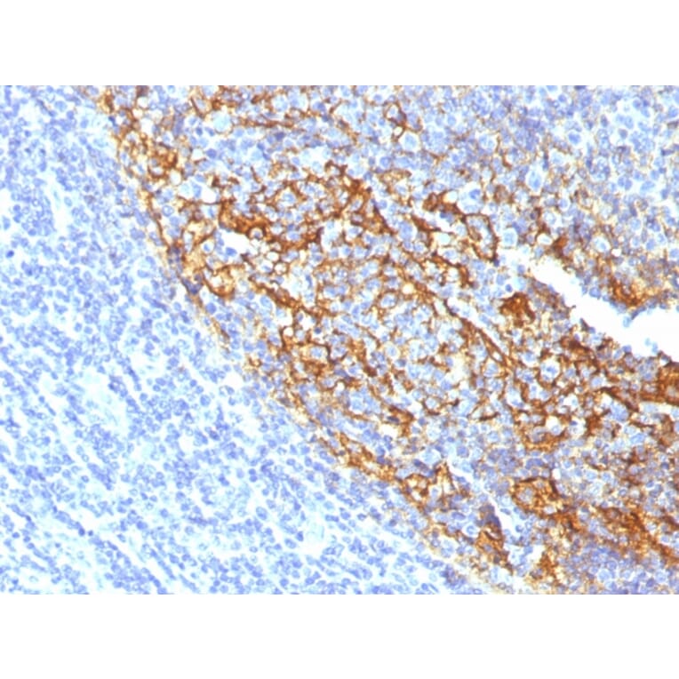 Immunohistochemistry - Anti-CD35 Antibody [To5] (A248259) - Antibodies.com