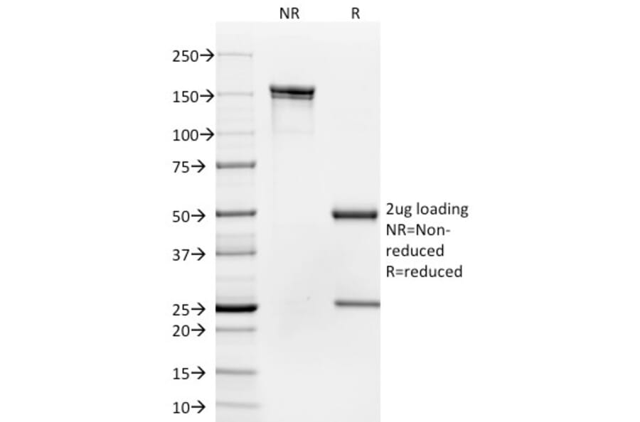 SDS-PAGE - Anti-CD35 Antibody [To5] (A248260) - Antibodies.com