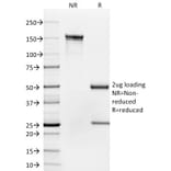SDS-PAGE - Anti-CD35 Antibody [To5] (A248260) - Antibodies.com