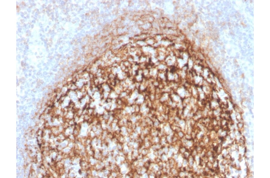 Immunohistochemistry - Anti-CD35 Antibody [CR1/4382R] (A248261) - Antibodies.com