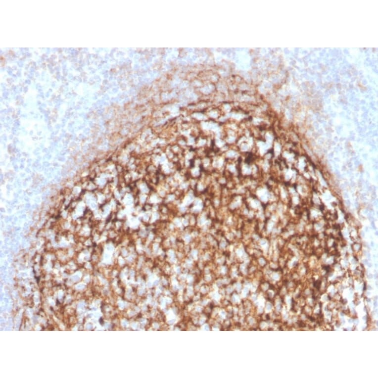 Immunohistochemistry - Anti-CD35 Antibody [CR1/4382R] (A248261) - Antibodies.com