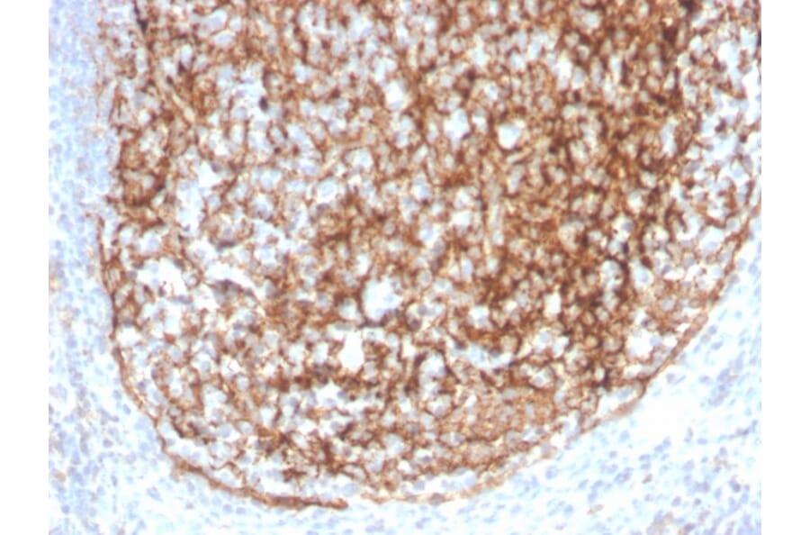 Immunohistochemistry - Anti-CD35 Antibody [CR1/4382R] (A248260) - Antibodies.com