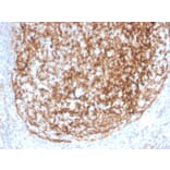 Immunohistochemistry - Anti-CD35 Antibody [CR1/4382R] (A248260) - Antibodies.com