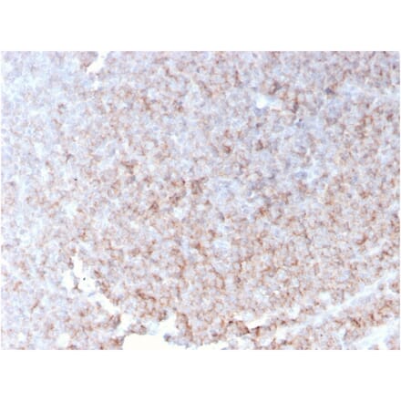 Immunohistochemistry - Anti-CD21 Antibody [rCR2/1952] (A248262) - Antibodies.com
