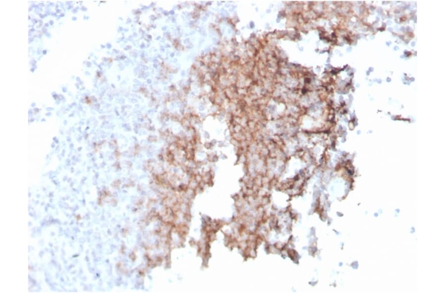 Immunohistochemistry - Anti-CD21 Antibody [rCR2/1952] (A248261) - Antibodies.com