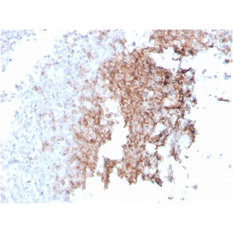 Immunohistochemistry - Anti-CD21 Antibody [rCR2/1952] (A248261) - Antibodies.com