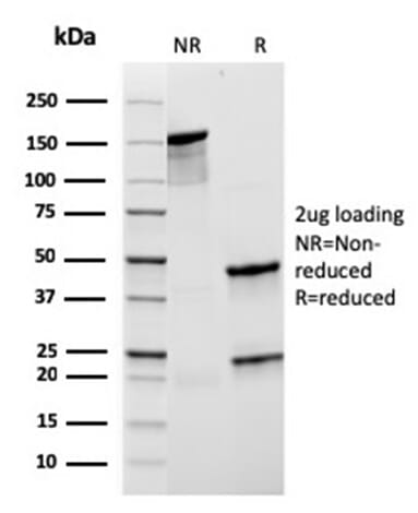 Recombinant Anti-CD21 Antibody [rCR2/1952] (A248262) | Antibodies.com