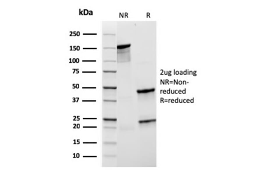 SDS-PAGE - Anti-CD21 Antibody [rCR2/1952] (A248262) - Antibodies.com