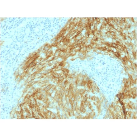 Immunohistochemistry - Anti-CD21 Antibody [CR2/1952] (A248263) - Antibodies.com