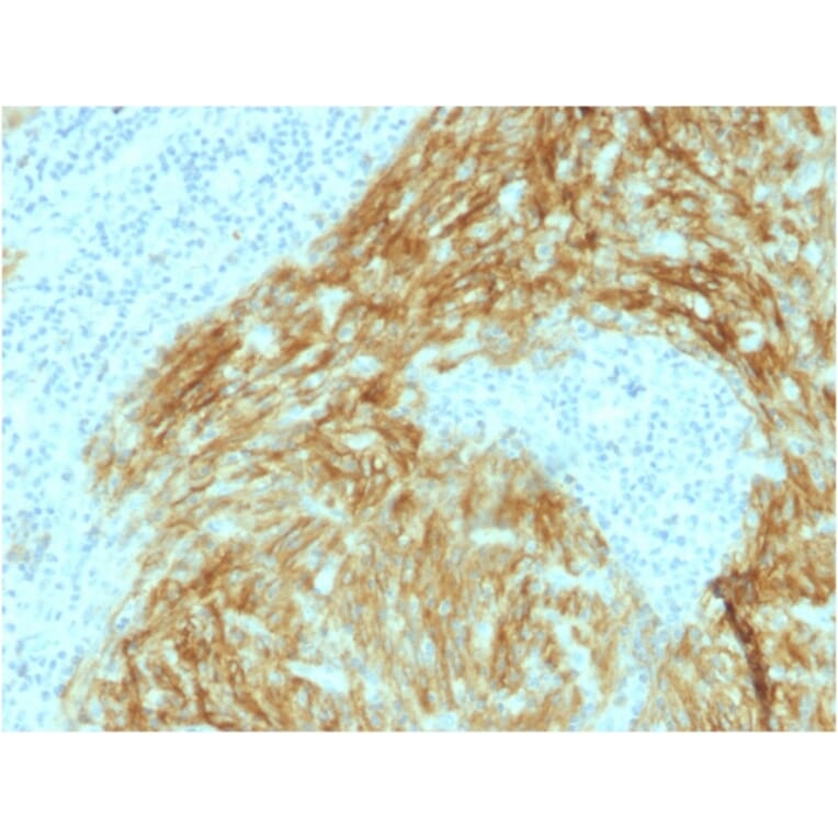 Immunohistochemistry - Anti-CD21 Antibody [CR2/1952] (A248263) - Antibodies.com