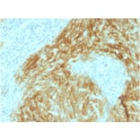 Immunohistochemistry - Anti-CD21 Antibody [CR2/1952] (A248263) - Antibodies.com