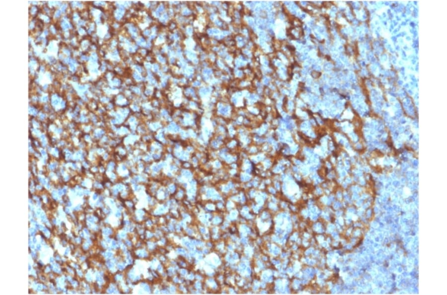 Immunohistochemistry - Anti-CD21 Antibody [CR2/1952] (A248263) - Antibodies.com