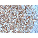 Immunohistochemistry - Anti-CD21 Antibody [CR2/1952] (A248263) - Antibodies.com
