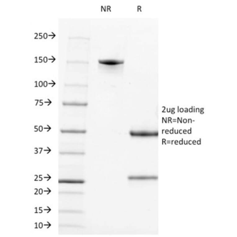 SDS-PAGE - Anti-CD21 Antibody [CR2/1952] (A248263) - Antibodies.com