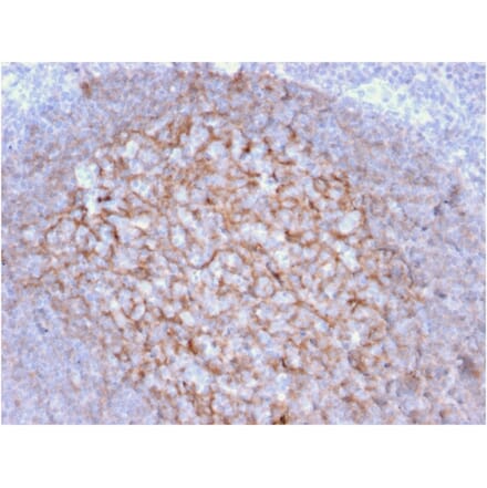 Immunohistochemistry - Anti-CD21 Antibody [CR2/1953] (A248264) - Antibodies.com