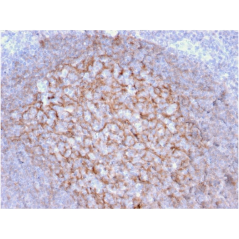 Immunohistochemistry - Anti-CD21 Antibody [CR2/1953] (A248264) - Antibodies.com