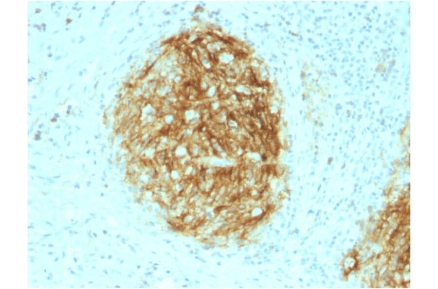 Immunohistochemistry - Anti-CD21 Antibody [CR2/1953] (A248264) - Antibodies.com
