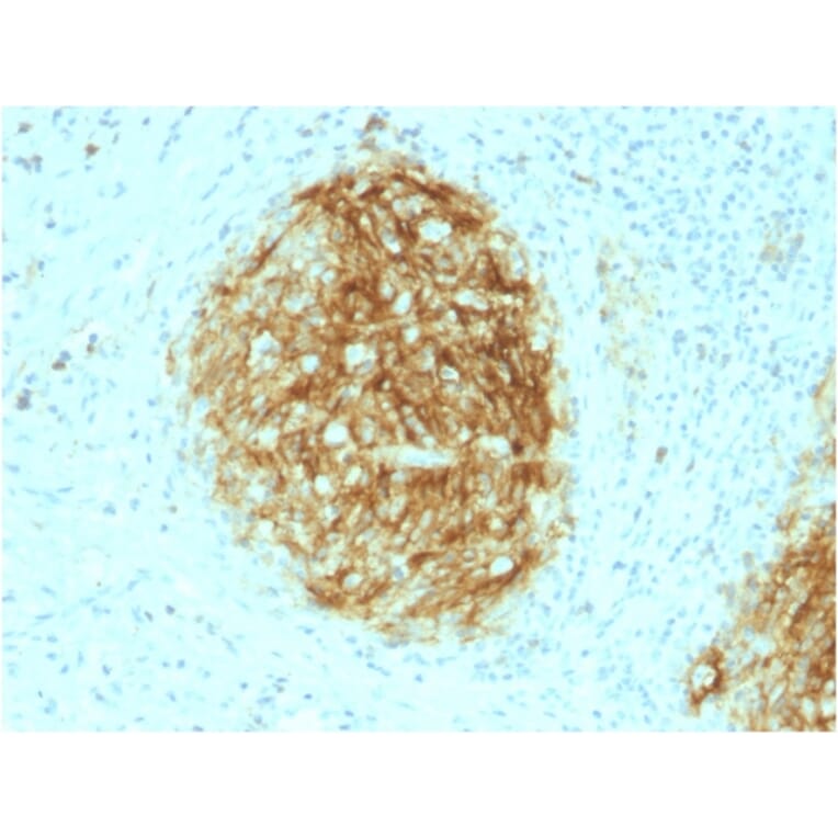 Immunohistochemistry - Anti-CD21 Antibody [CR2/1953] (A248264) - Antibodies.com