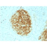 Immunohistochemistry - Anti-CD21 Antibody [CR2/1953] (A248264) - Antibodies.com