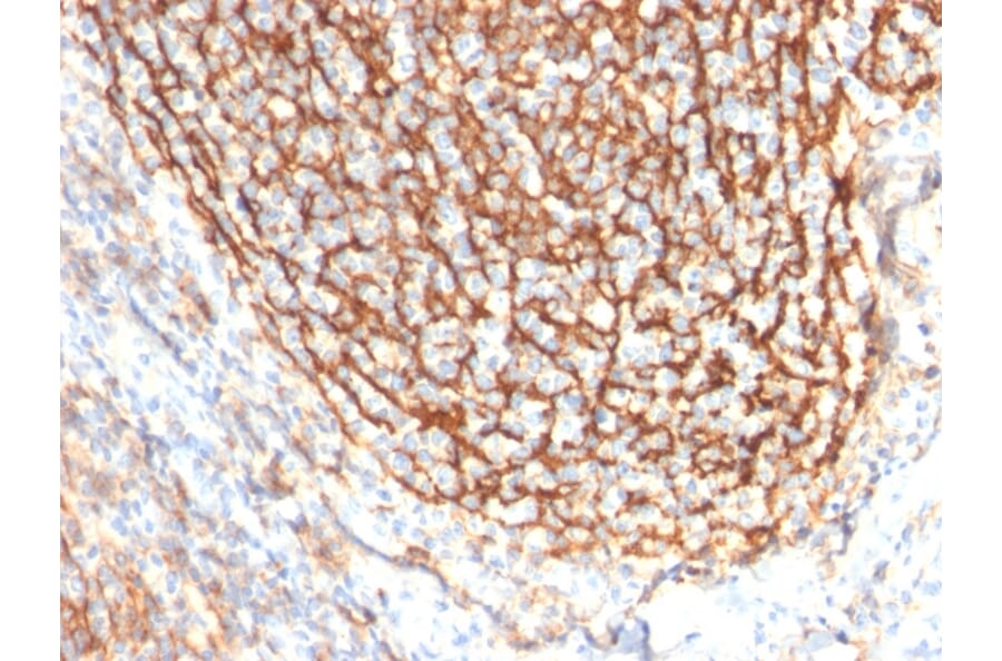Immunohistochemistry - Anti-CD21 Antibody [CR2/2754] (A248265) - Antibodies.com