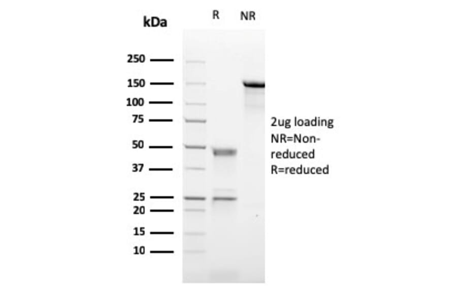 SDS-PAGE - Anti-CD21 Antibody [CR2/2754] (A248265) - Antibodies.com