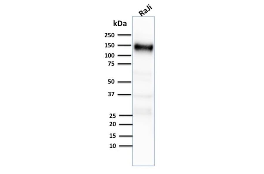 Western Blot - Anti-CD21 Antibody [CR2/2754] (A248265) - Antibodies.com
