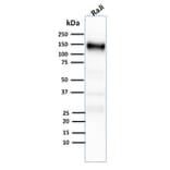 Western Blot - Anti-CD21 Antibody [CR2/2754] (A248265) - Antibodies.com