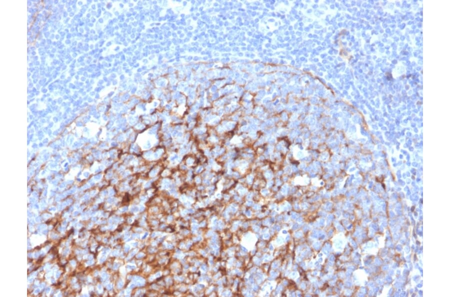 Immunohistochemistry - Anti-CD21 Antibody [CR2/3247] (A248266) - Antibodies.com