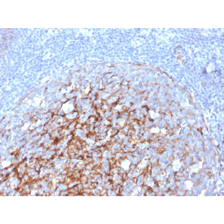 Immunohistochemistry - Anti-CD21 Antibody [CR2/3247] (A248266) - Antibodies.com