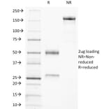 SDS-PAGE - Anti-CD21 Antibody [CR2/3247] (A248266) - Antibodies.com