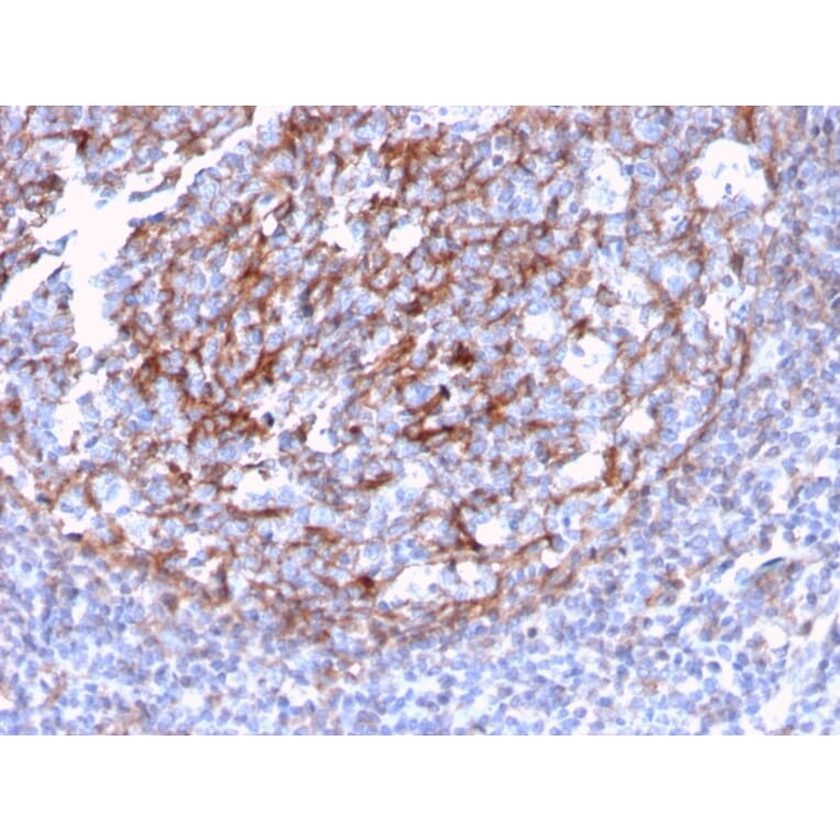 Immunohistochemistry - Anti-CD21 Antibody [CR2/3124R] (A248267) - Antibodies.com
