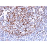 Immunohistochemistry - Anti-CD21 Antibody [CR2/3124R] (A248267) - Antibodies.com