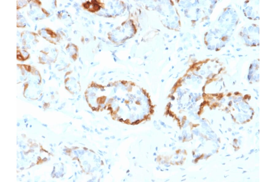 Immunohistochemistry - Anti-alpha B Crystallin Antibody [CPTC-CRYAB-1] (A248269) - Antibodies.com