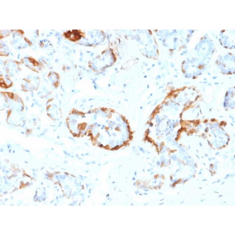 Immunohistochemistry - Anti-alpha B Crystallin Antibody [CPTC-CRYAB-1] (A248269) - Antibodies.com