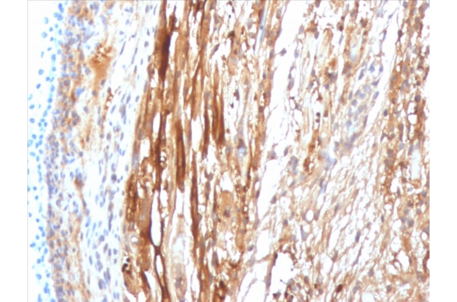 Immunohistochemistry - Anti-alpha B Crystallin Antibody [CPTC-CRYAB-1] (A248269) - Antibodies.com