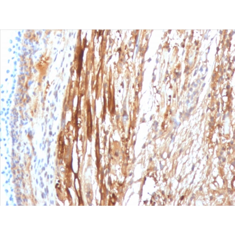 Immunohistochemistry - Anti-alpha B Crystallin Antibody [CPTC-CRYAB-1] (A248269) - Antibodies.com