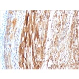 Immunohistochemistry - Anti-alpha B Crystallin Antibody [CPTC-CRYAB-1] (A248269) - Antibodies.com