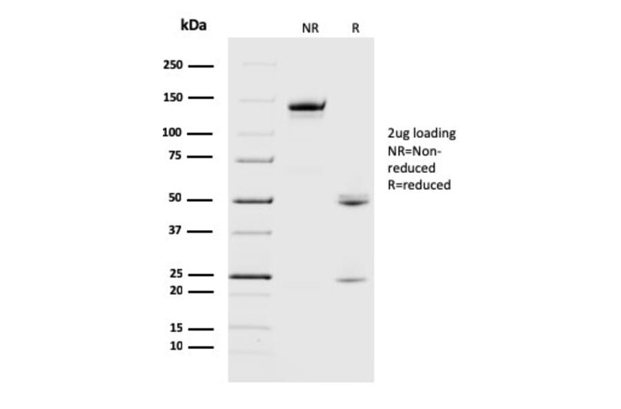 SDS-PAGE - Anti-alpha B Crystallin Antibody [CPTC-CRYAB-1] (A248269) - Antibodies.com