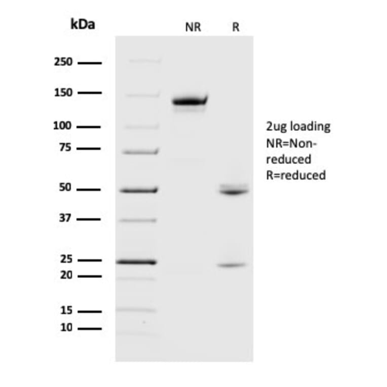 SDS-PAGE - Anti-alpha B Crystallin Antibody [CPTC-CRYAB-1] (A248269) - Antibodies.com