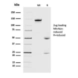 SDS-PAGE - Anti-alpha B Crystallin Antibody [CPTC-CRYAB-1] (A248269) - Antibodies.com