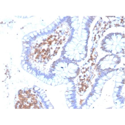 Immunohistochemistry - Anti-MAPK14 Antibody [CPTC-MAPK14-1] (A248270) - Antibodies.com