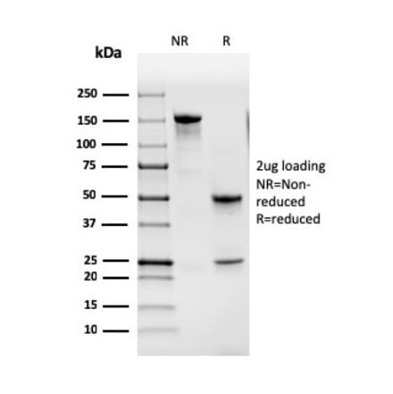 SDS-PAGE - Anti-GM-CSF Antibody [CSF2/3402] (A248271) - Antibodies.com