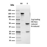 SDS-PAGE - Anti-GM-CSF Antibody [CSF2/3402] (A248271) - Antibodies.com