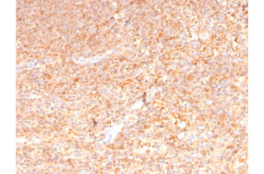 Immunohistochemistry - Anti-GM-CSF Antibody [CSF2/3402] (A248271) - Antibodies.com