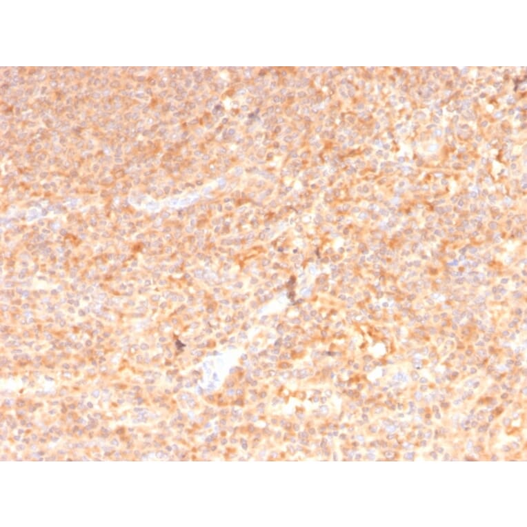 Immunohistochemistry - Anti-GM-CSF Antibody [CSF2/3402] (A248271) - Antibodies.com