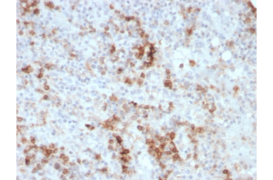 Immunohistochemistry - Anti-GM-CSF Antibody [CSF2/3403] (A248272) - Antibodies.com